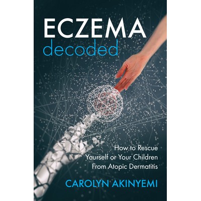 Eczema Decoded by Carolyn Akinyemi